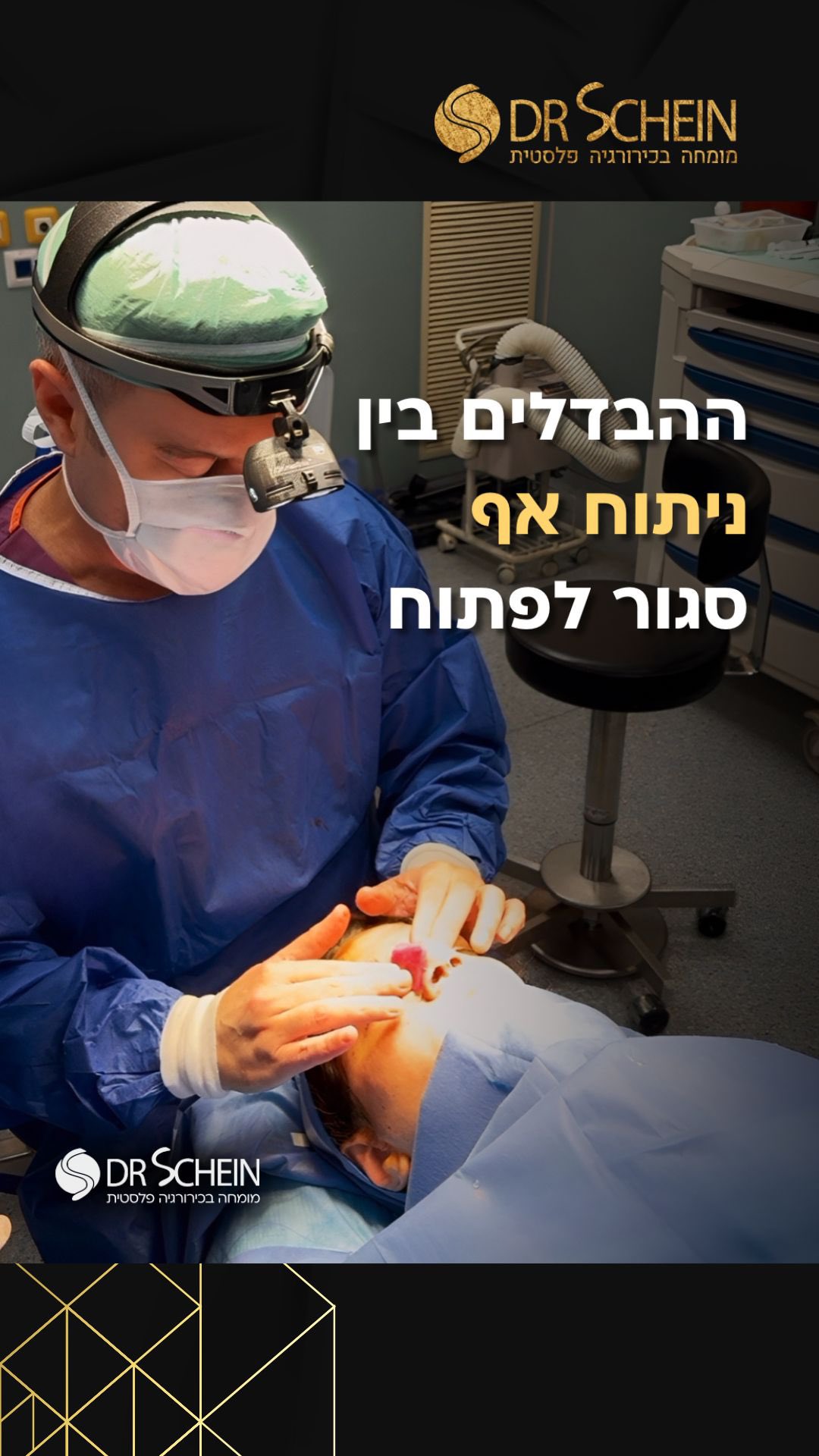 ניתוח אף פתוח או סגור – מה ההבדל בעצם?