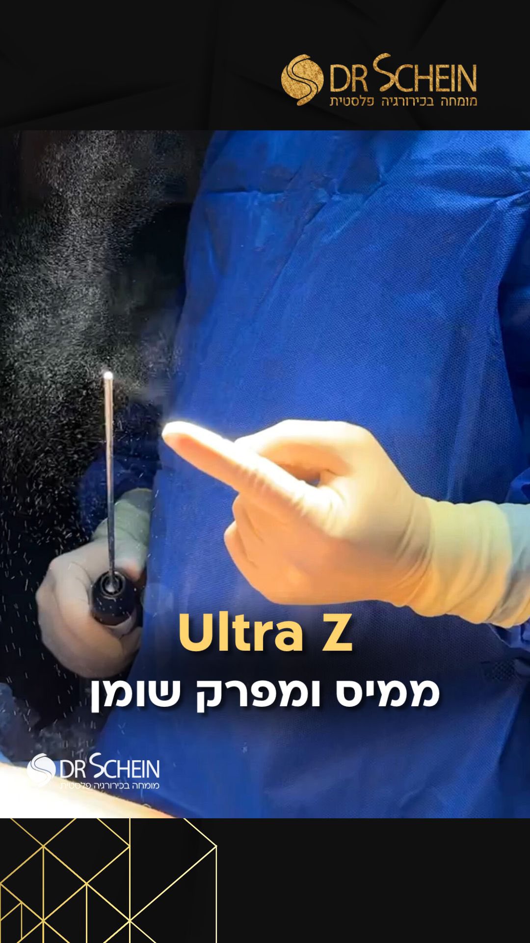 הכירו את ה-Ultra Z
