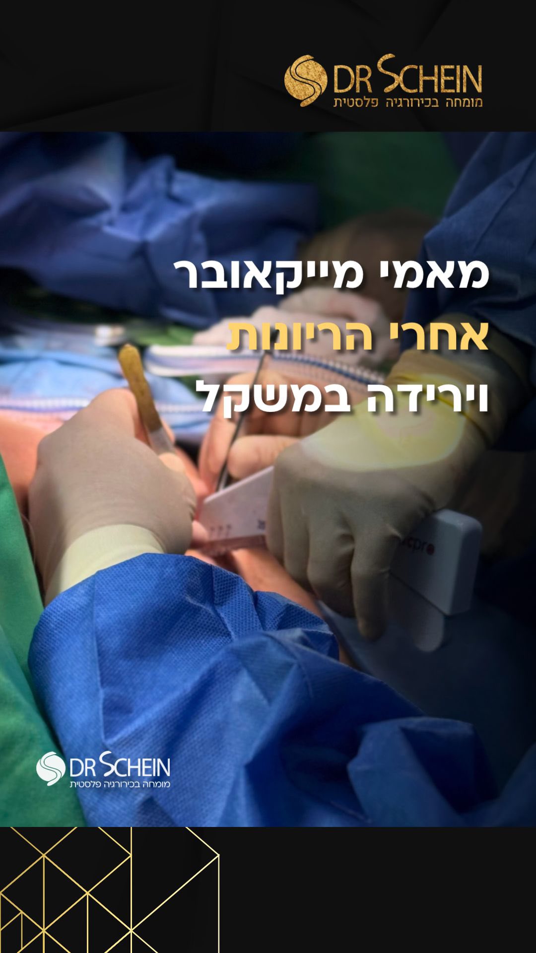 מאמי מייקאובר הינו ניתוח המשלב מתיחת בטן עם ניתוח חזה