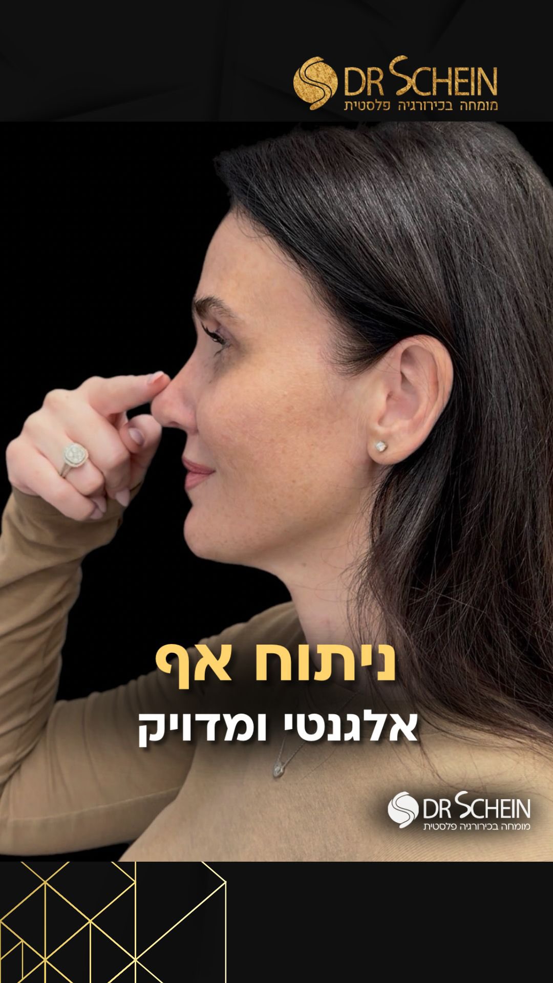 רק חודש לאחר ניתוח אף פתוח
